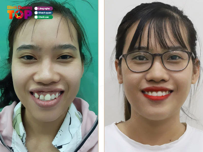nha-khoa-linh-xuan-binhduongtoplist