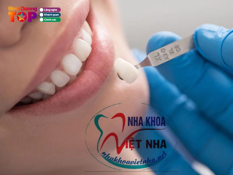 nha-khoa-viet-nha-binhduongtoplist