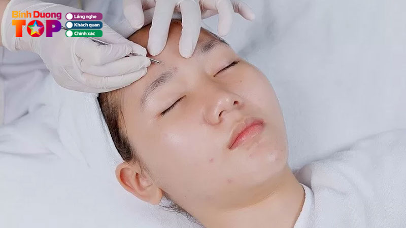 Top-10-spa-lay-nhan-mun-o-binh-duong-tan-goc-chuan-y-khoa-binhduongtoplist