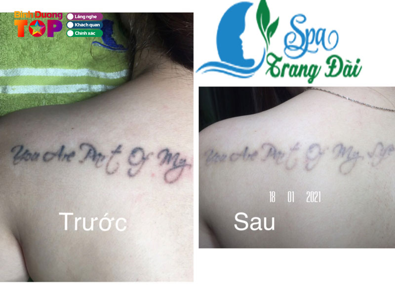Spa-trang-dai-binhduongtoplist