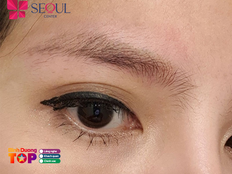 Tham-my-seoul-center-binhduongtoplist