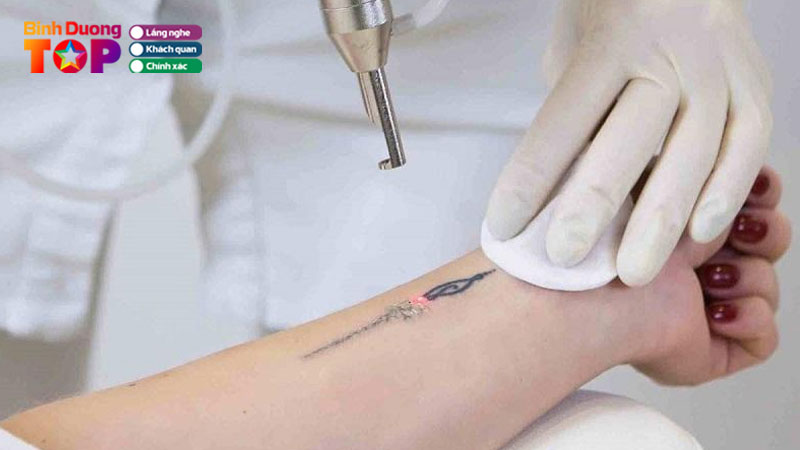 Top-5-dia-chi-xoa-xam-o-binh-duong-cong-nghe-cao-khong-de-seo-binhduongtoplist