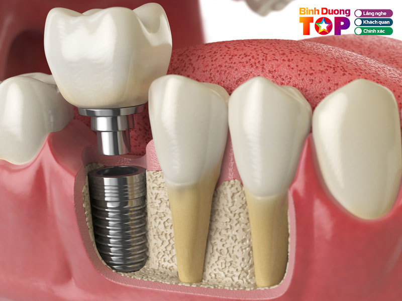 Nha-khoa-dai-nam-binhduongtoplist