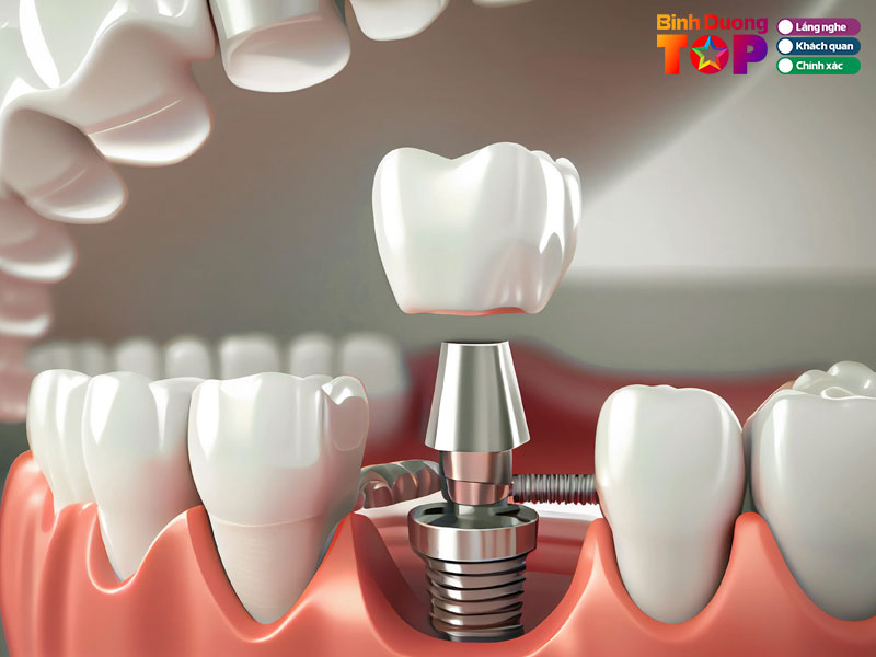 Nha-khoa-drhieu-binhduongtoplist