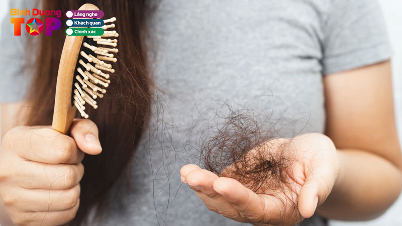 Top-5-dia-chi-chua-rung-toc-tai-binh-duong-hieu-qua-binhduongtoplist